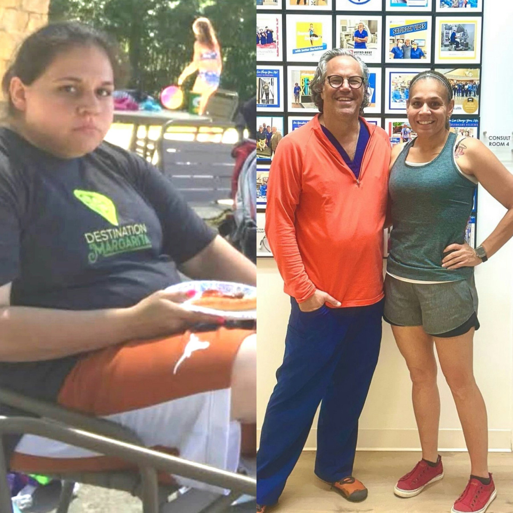 Before and After of a real Texas Center patient