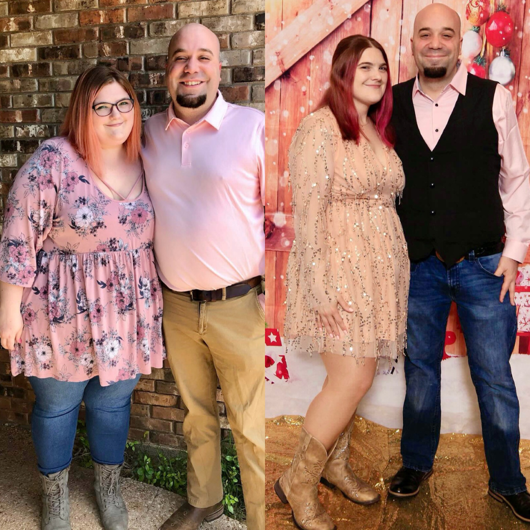 Jack and Allie before and after bariatrics