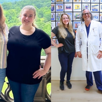 Before and after images of real bariatric surgery patients