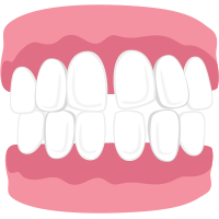 gapped teeth