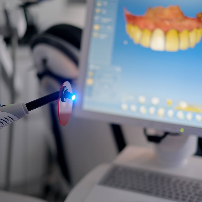 Intraoral scanner and CEREC software