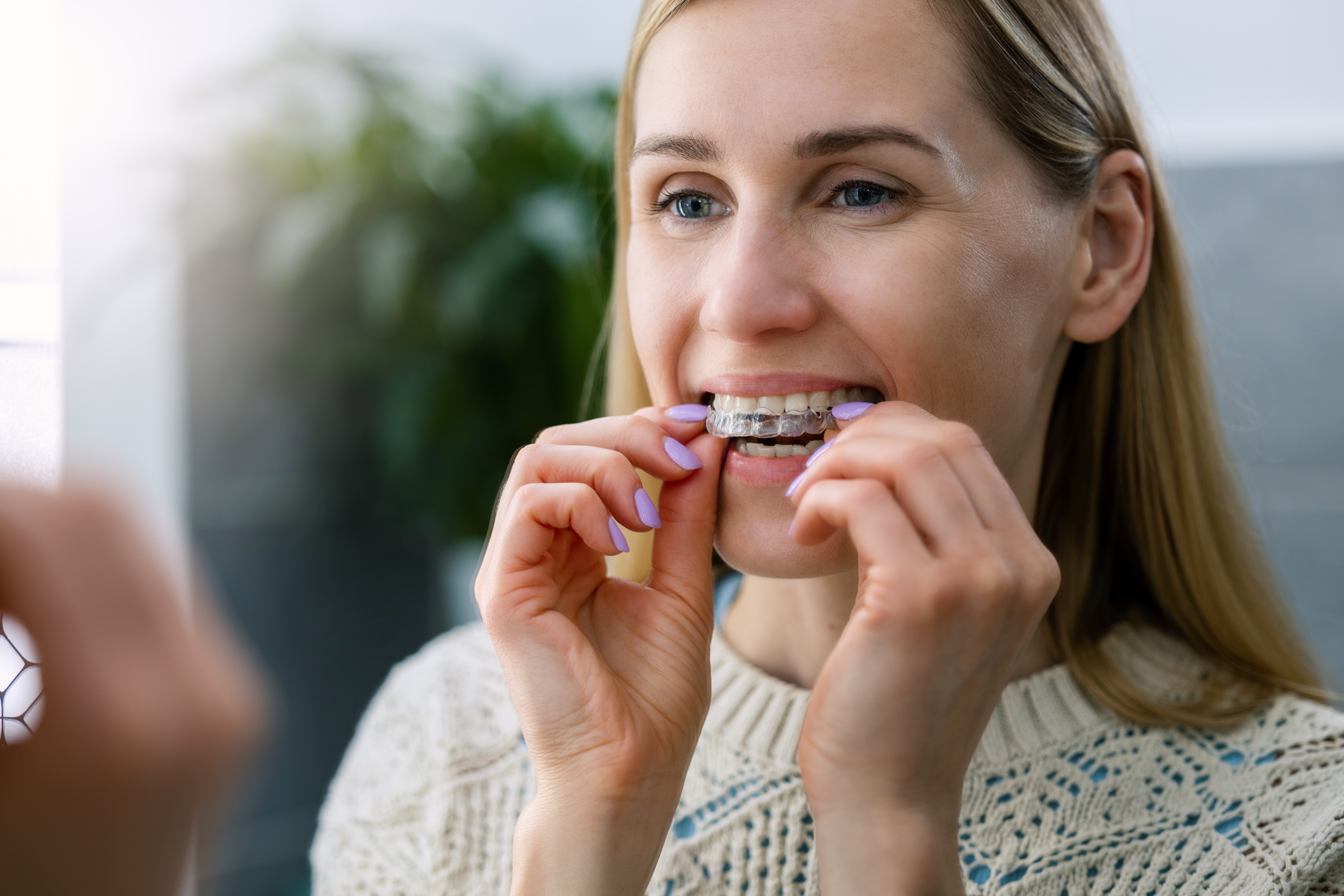 Girl placing Invisalign aligner