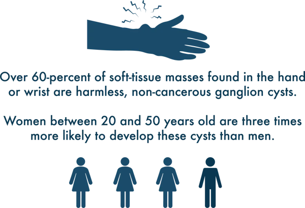 Ganglion cyst statistic