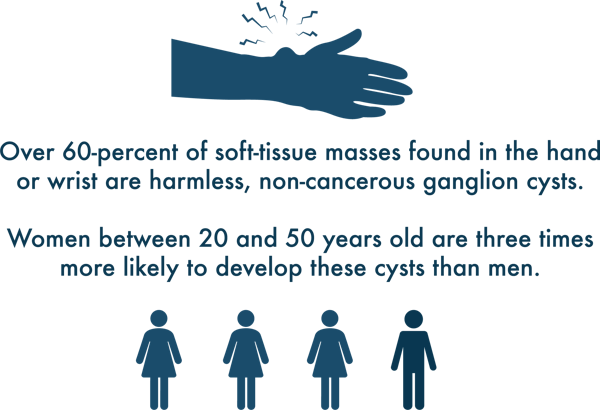 Ganglion cyst statistic