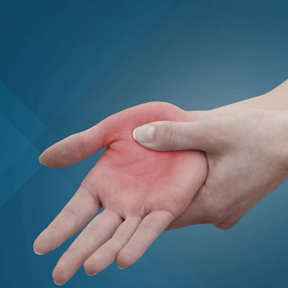 Painful hand