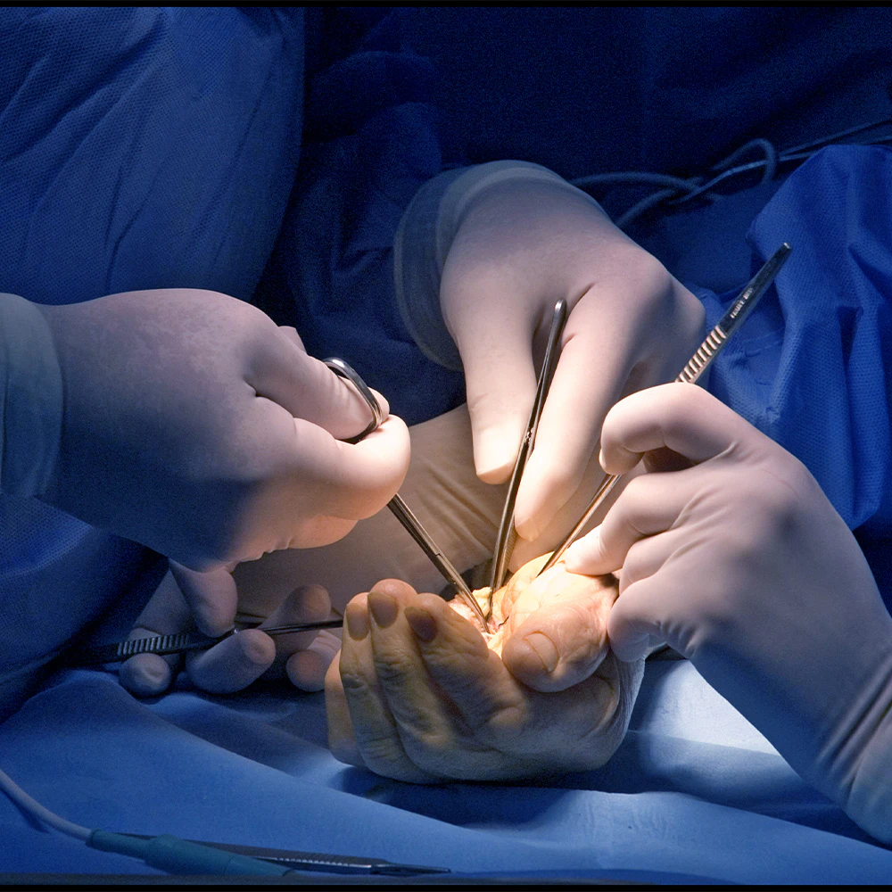 hand surgery being performed