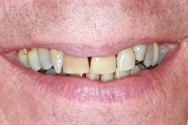 Case 2 before procedure