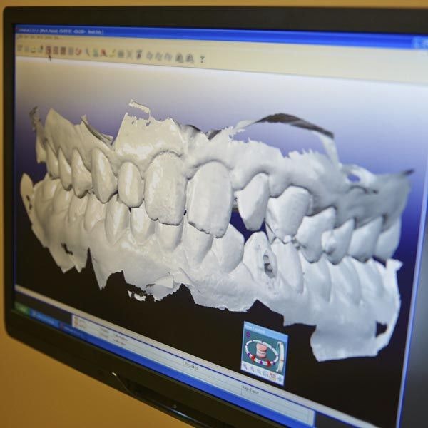 digital dental technology