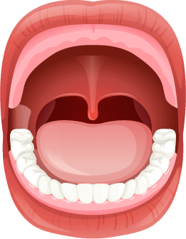 illustration of a mouth missing all upper teeth