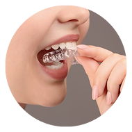 woman putting in clear aligner