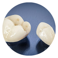 two dental crowns