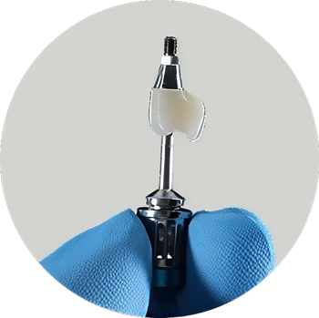 Dental Implant
