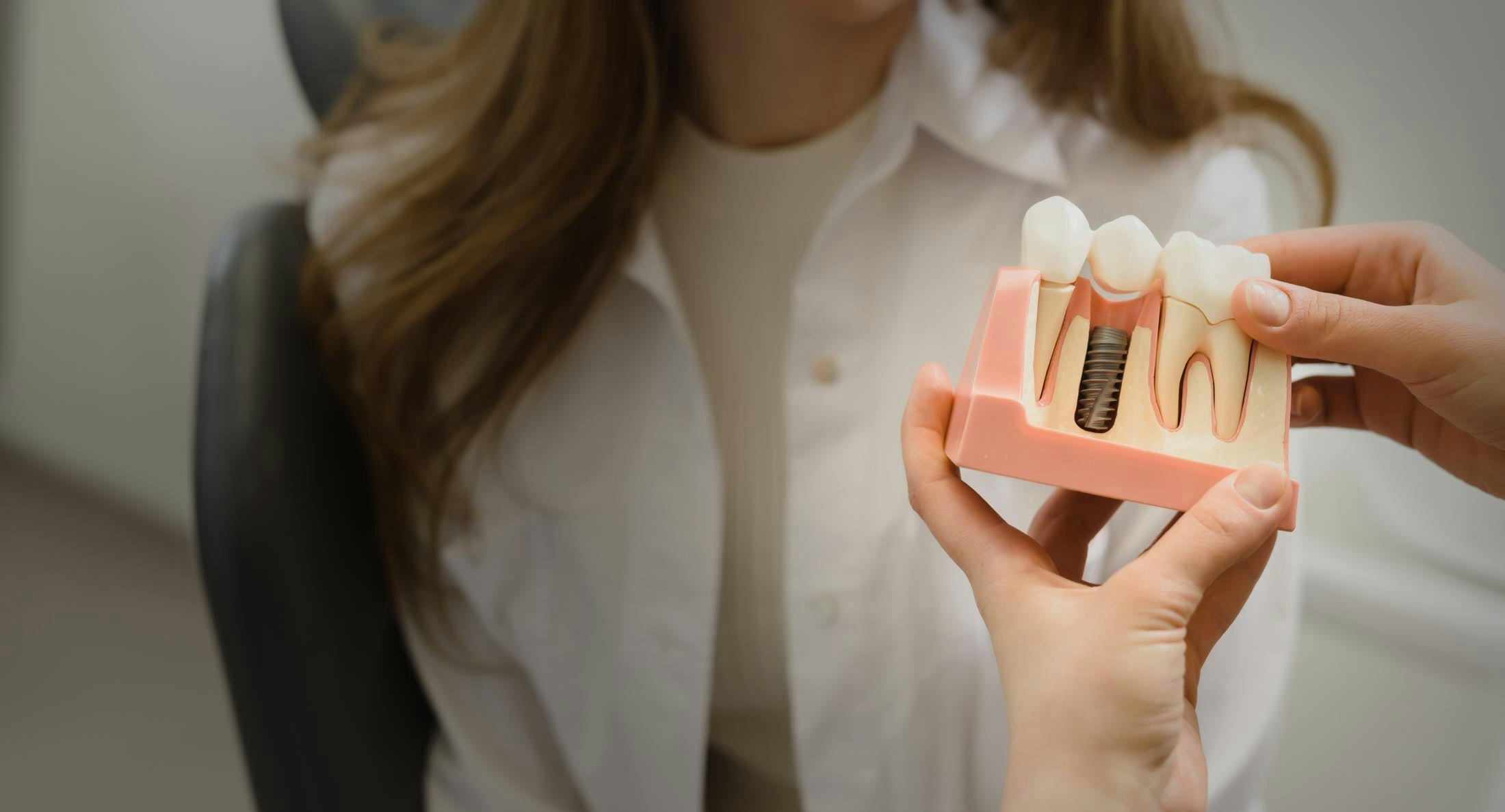 Illustration of restoration attaching to dental implant