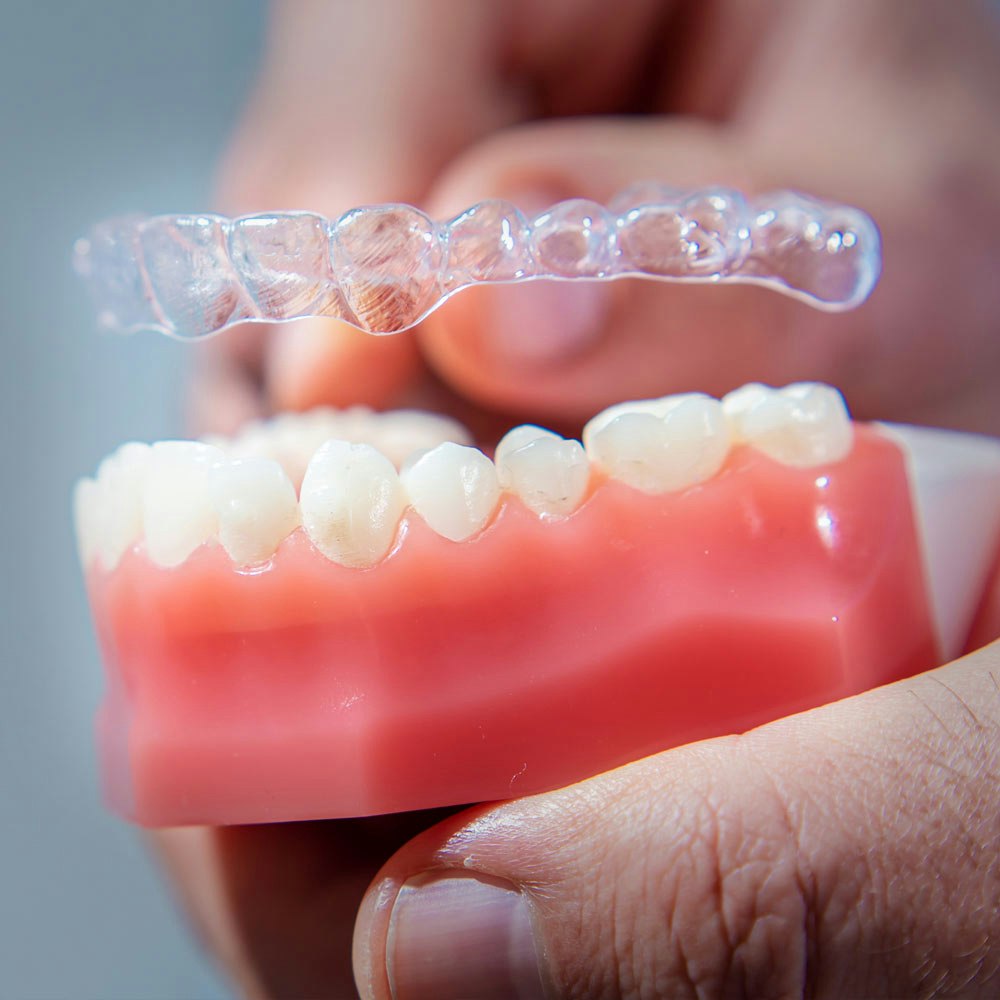 Invisalign over model teeth