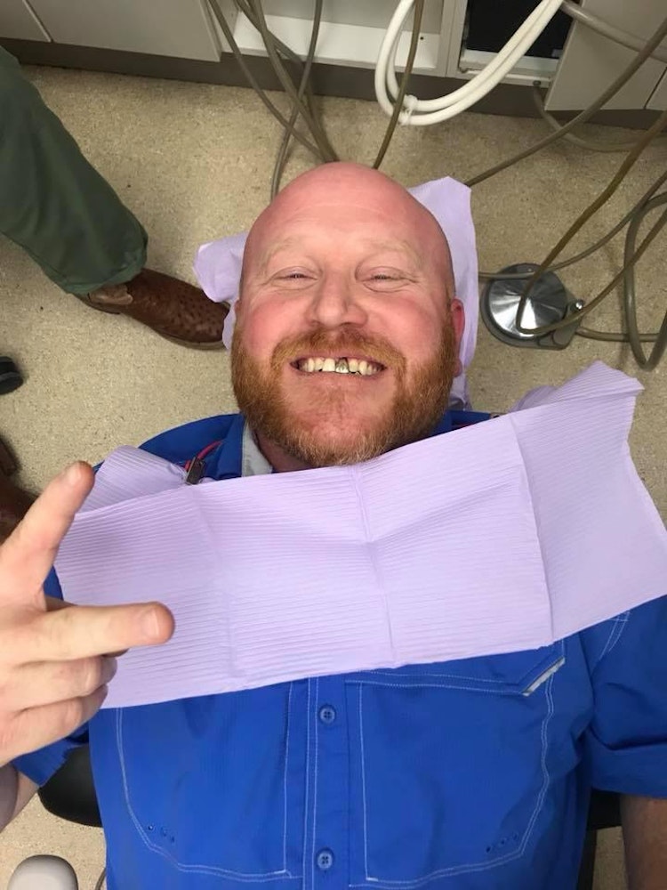 Smiling man missing a tooth in the exam chair