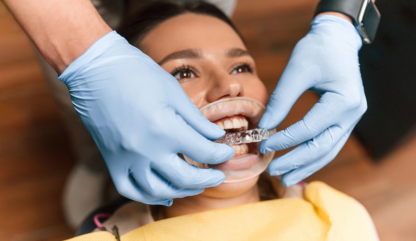 woman being fitted for Invisalign aligners