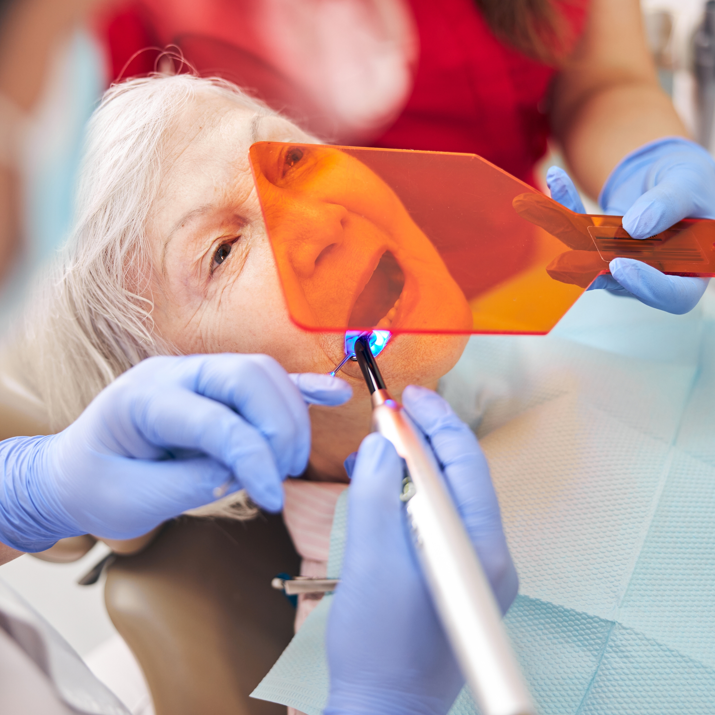 dental bonding procedure