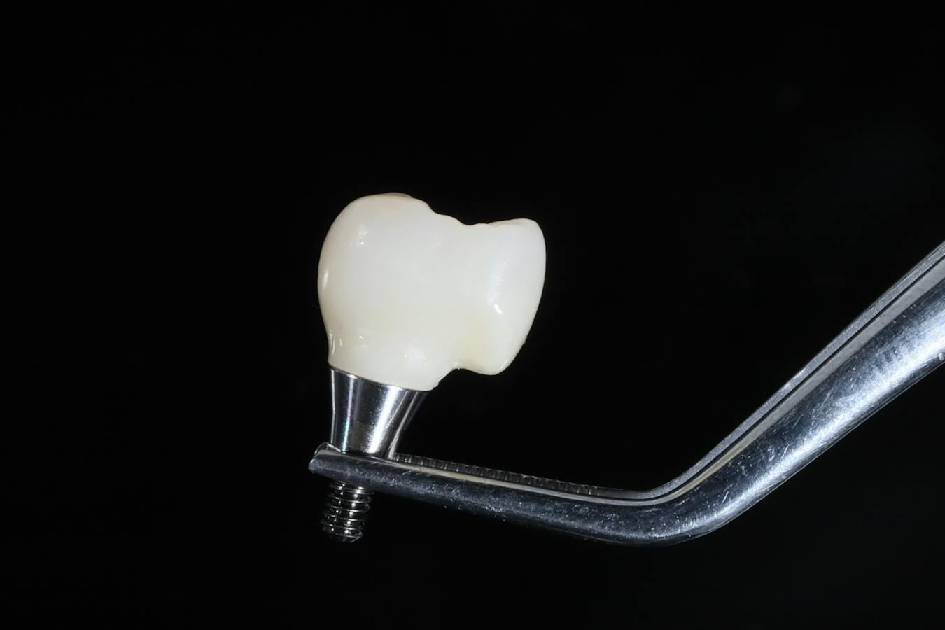 implant-supported crown