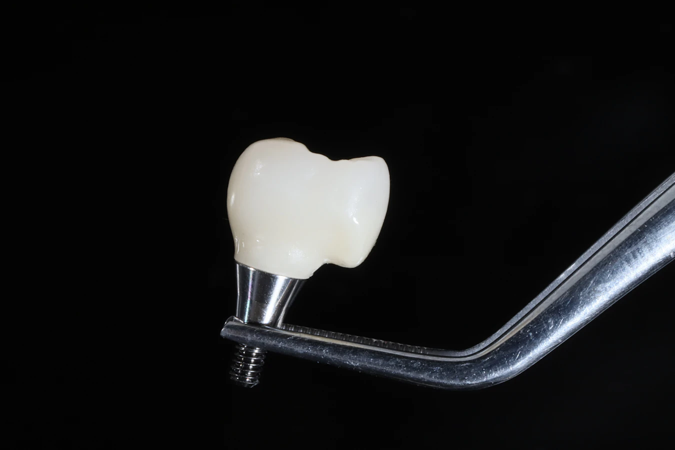 implant-supported crown