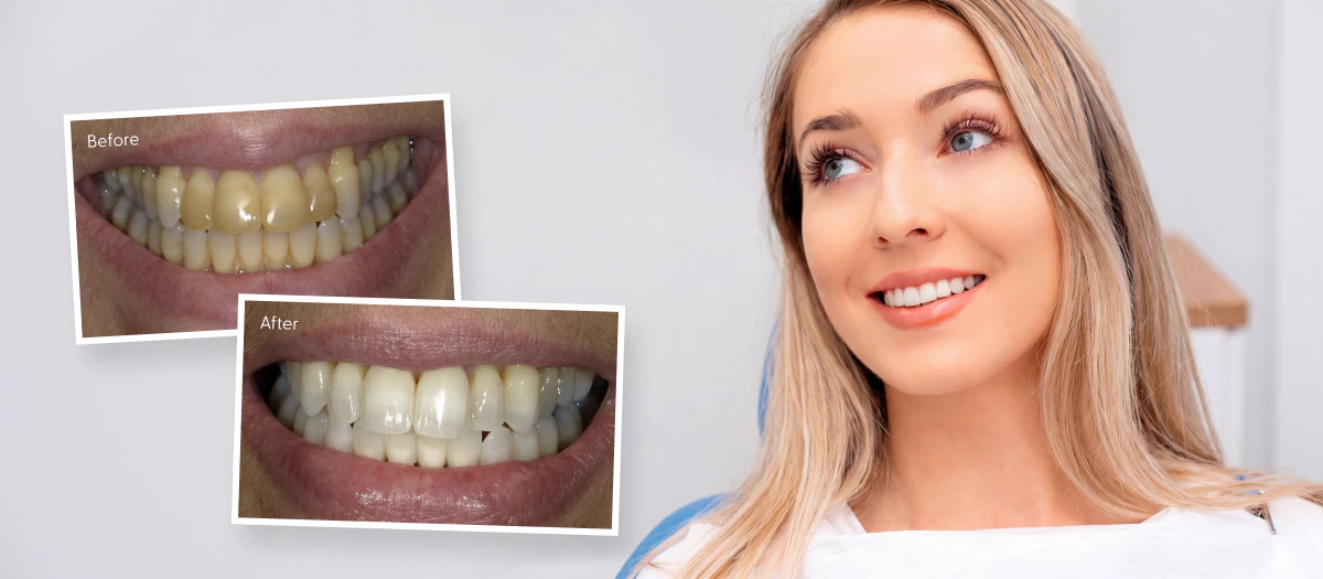 Woman smiling with a bright, healthy smile after teeth whitening