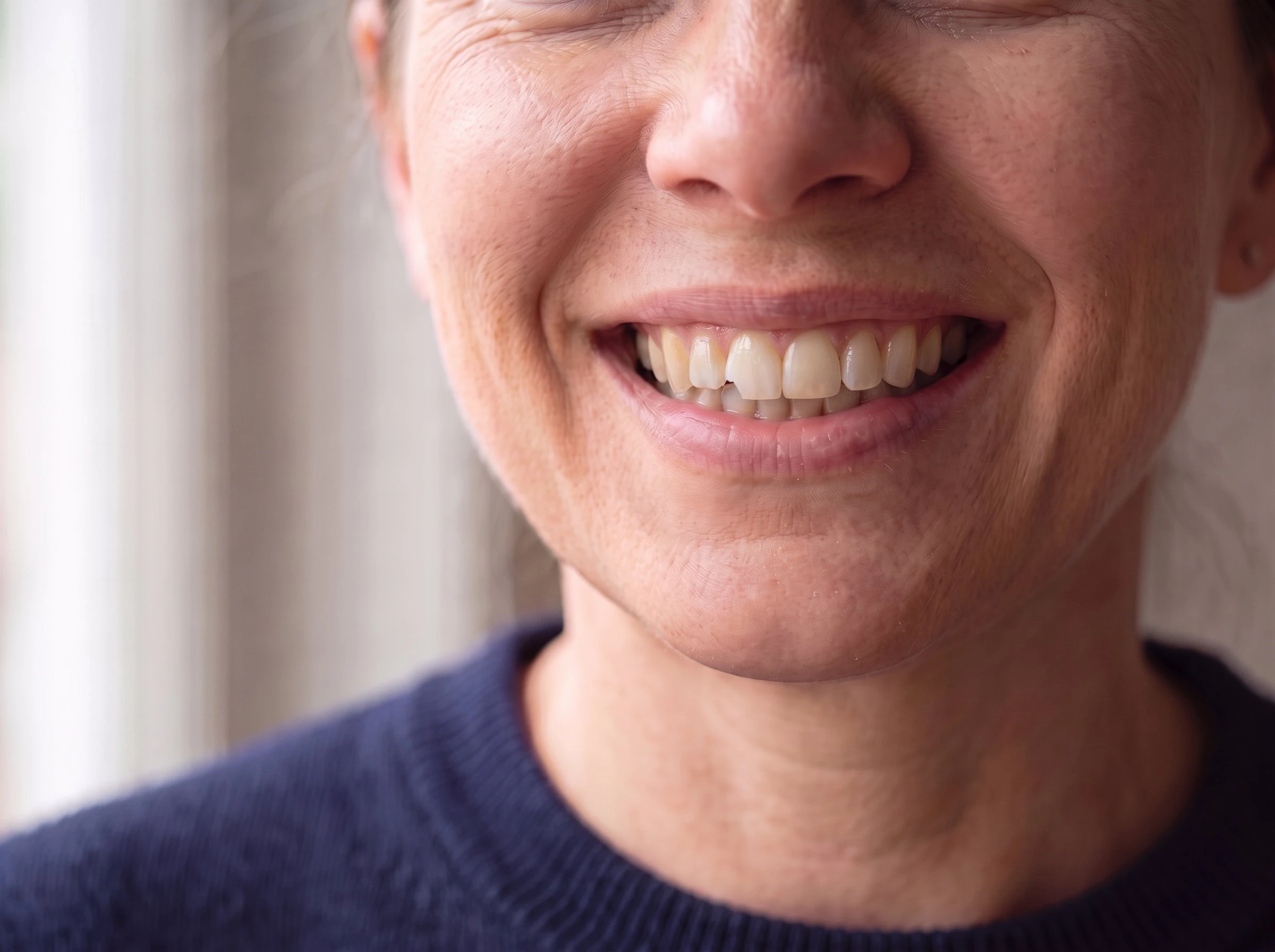 Woman with a small chip and uneven shade on her front teeth
