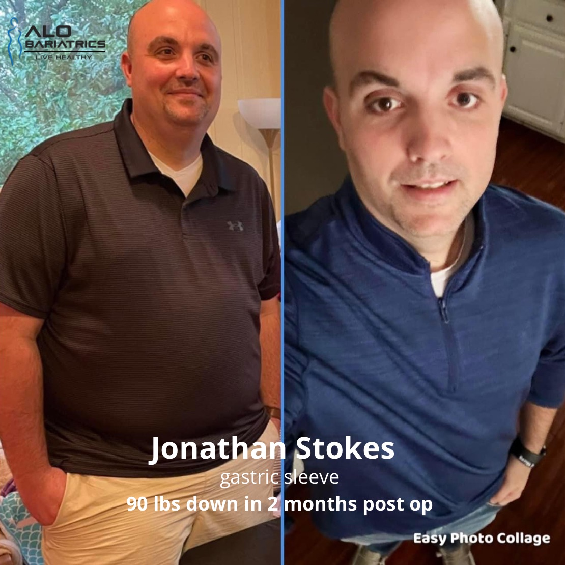 Before And After Weight Loss Surgery