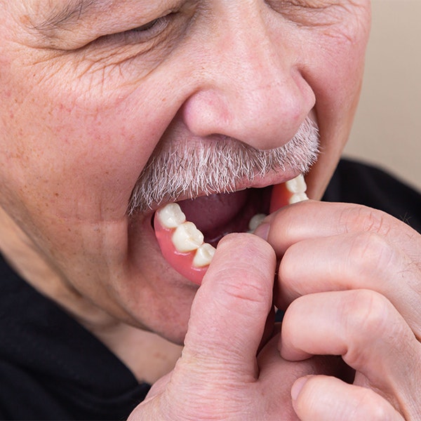 a man inserting dentures