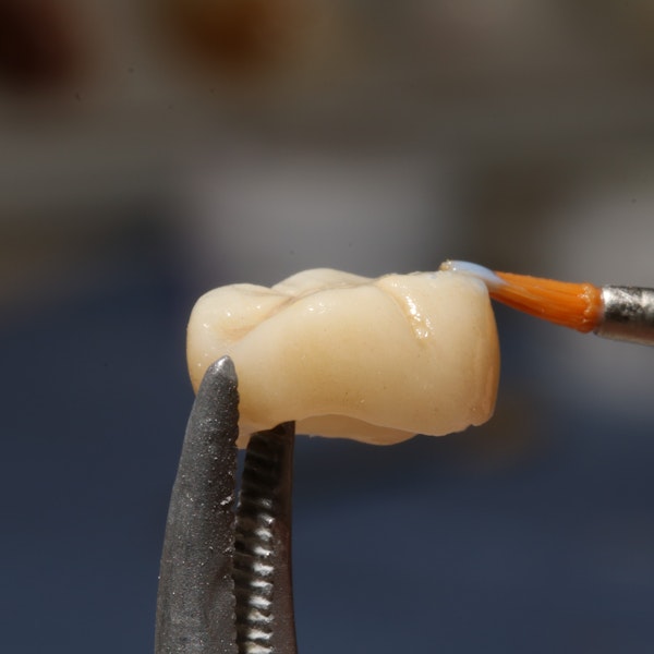 Dental crowns
