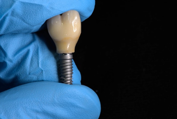 Dental crown implants
