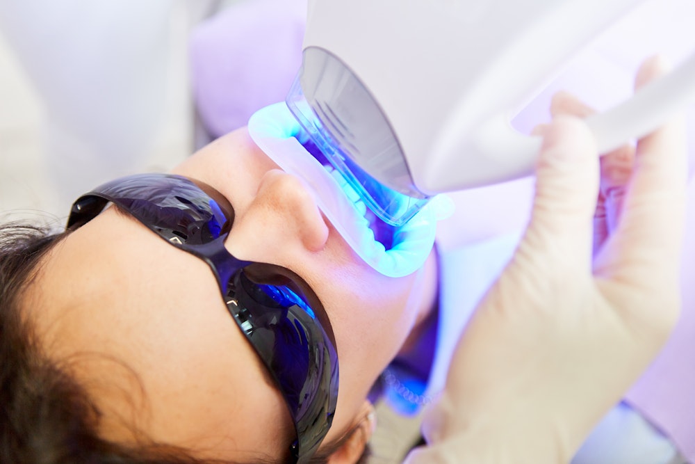 teeth whitening procedure