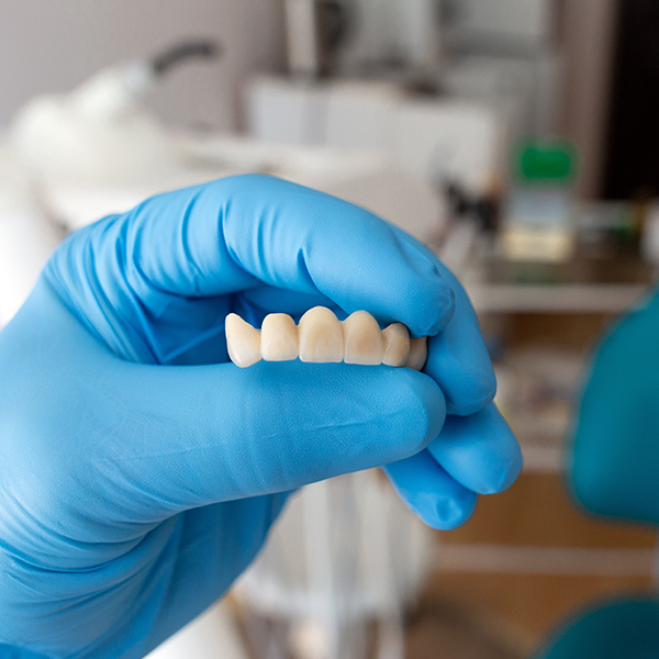 dentist holding a dental bridge in a blue gloved hand