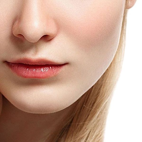 cheek augmentation