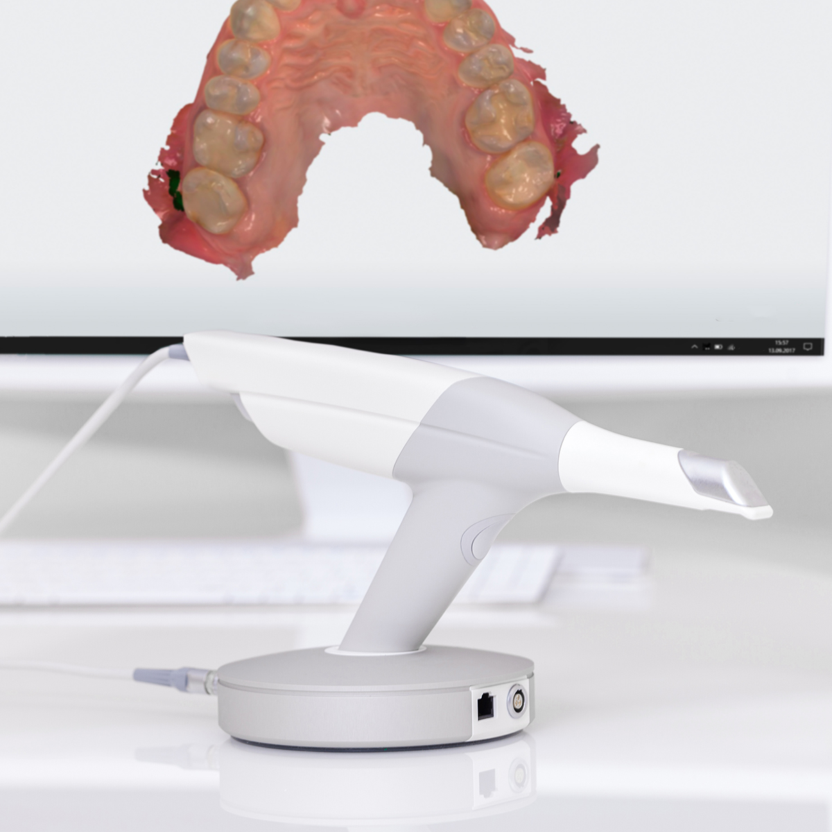 Intraoral Scanner