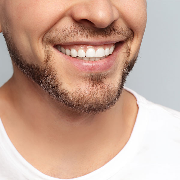 Close-up of a gummy smile