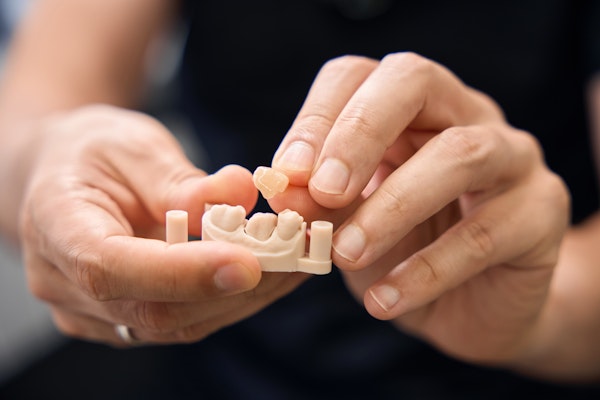 Dental Crown being placed on model