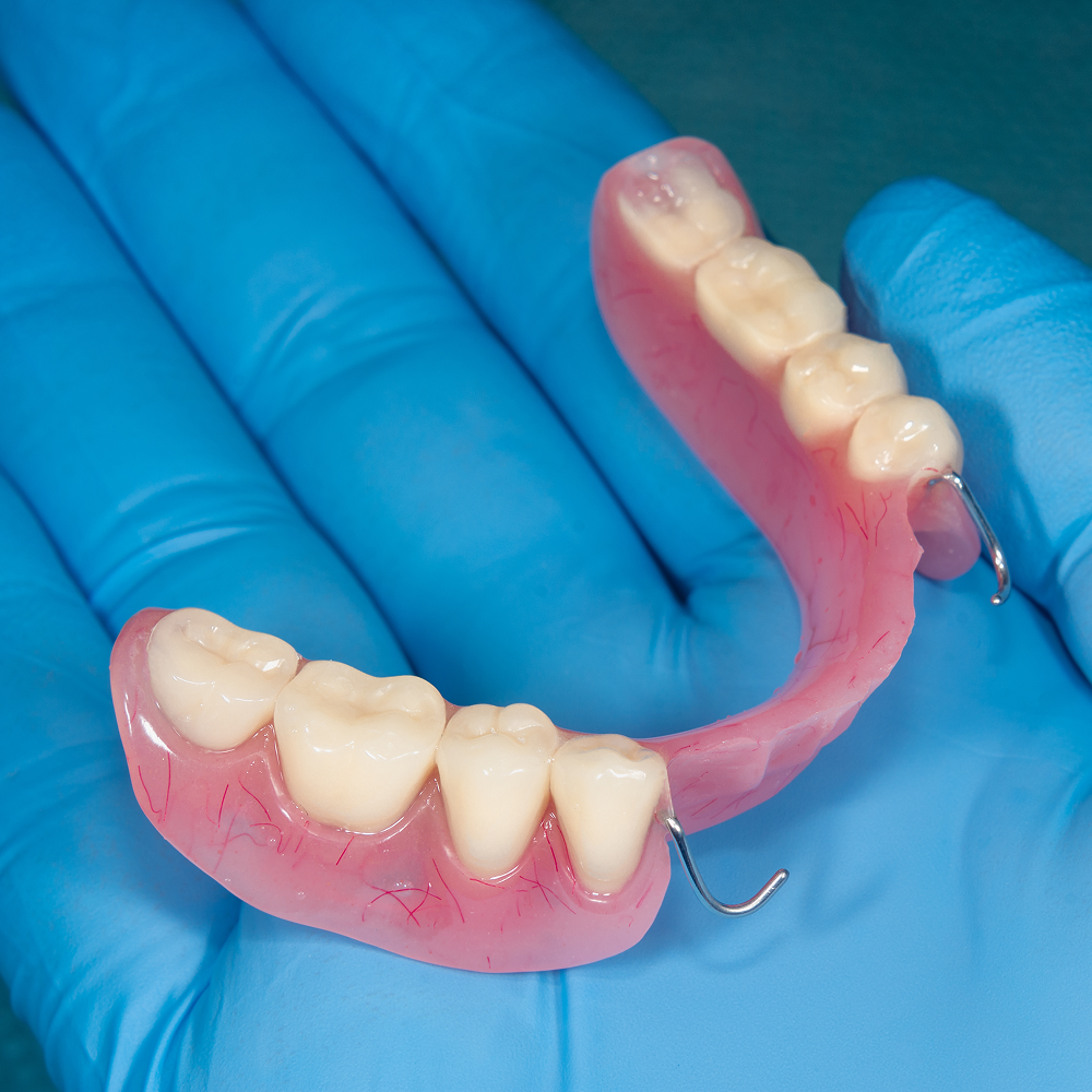 Blue gloved hand holding a partial denture