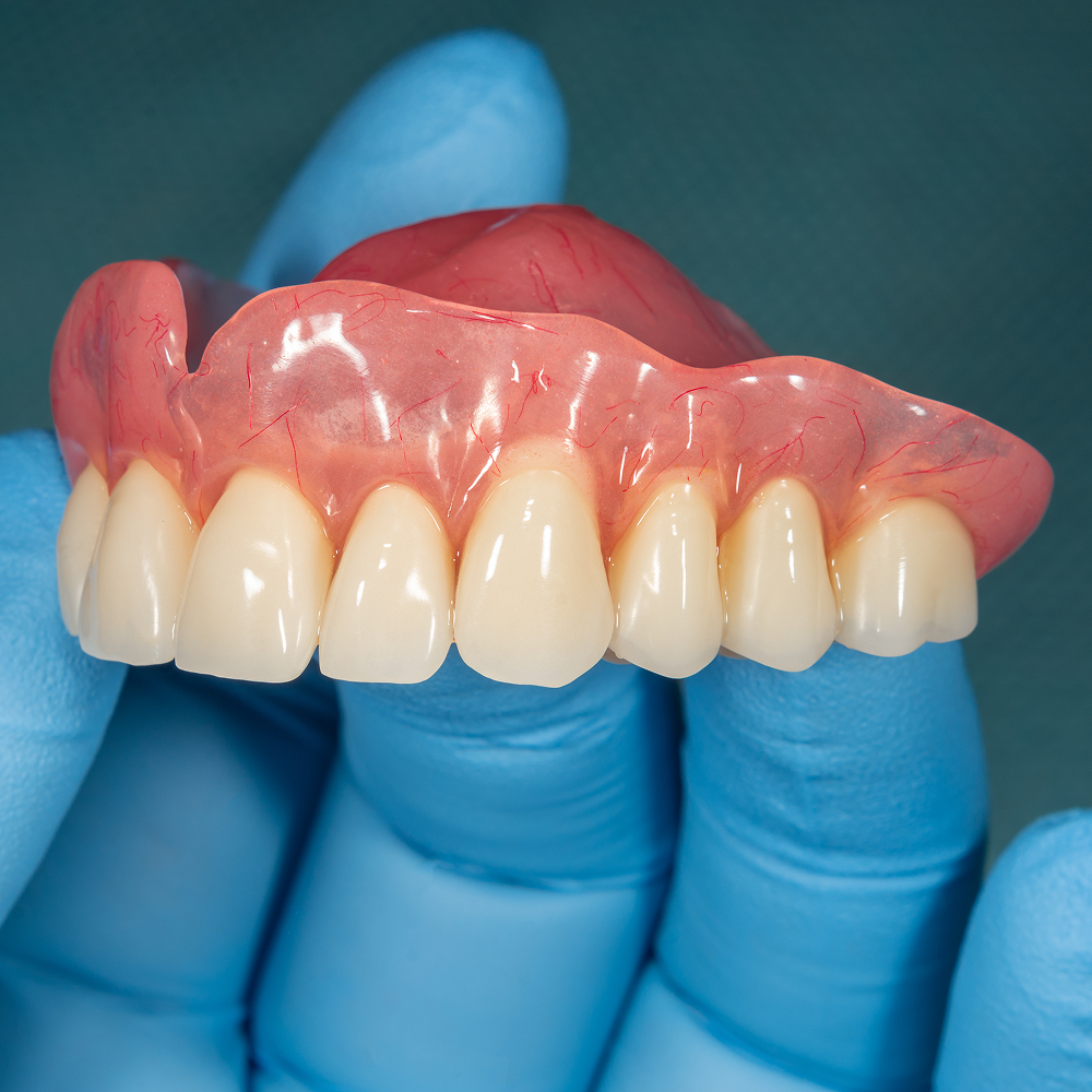 Blue gloved hand holding a traditional denture