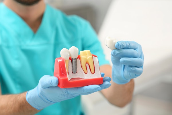 dentist holding model of implant-supported and traditional dental crown.
