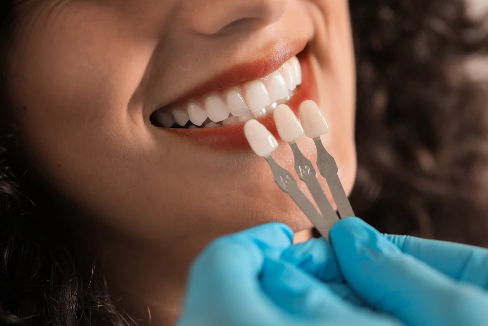 woman getting her veneers shade matched to her teeth
