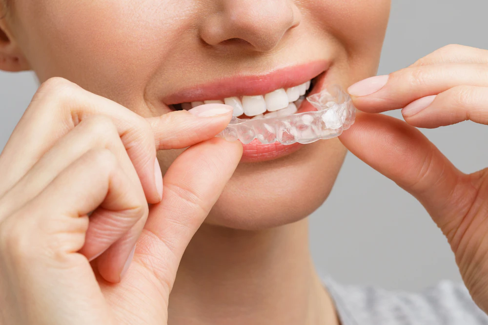 woman putting in whitening tray