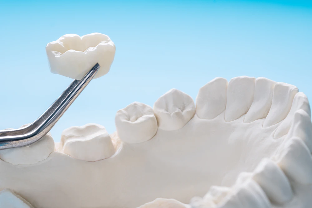 dental crown