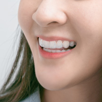 Woman wearing Invisalign aligners