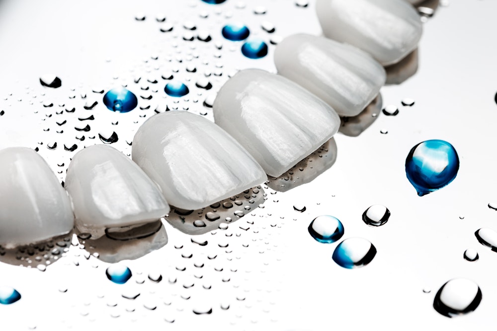 Close-up of dental veneers