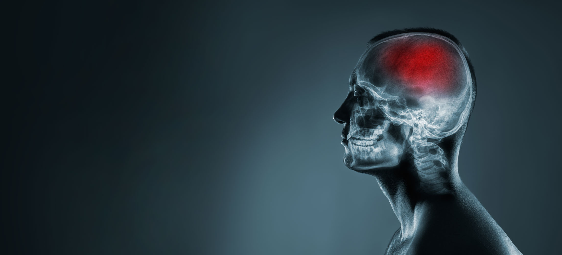 X-ray superimposed on the torso