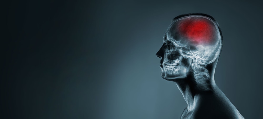 X-ray superimposed on the torso