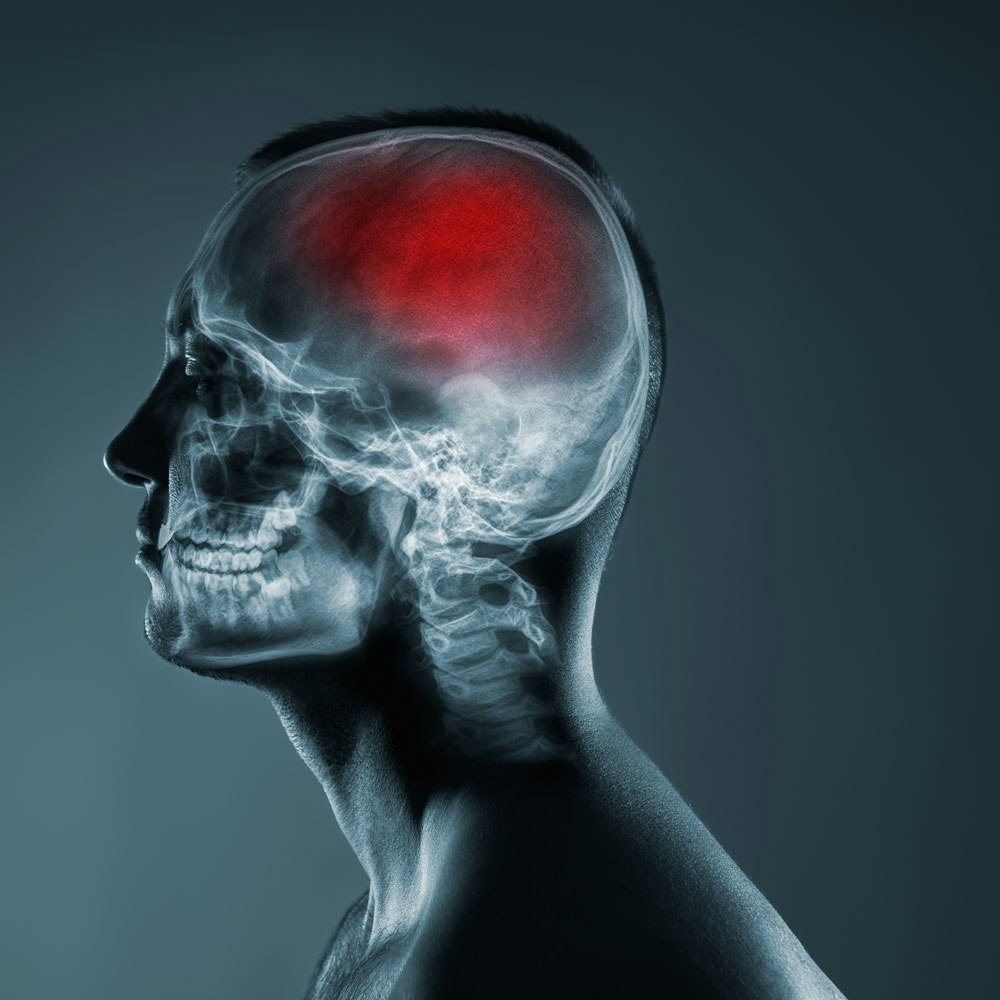 X-ray superimposed on the torso