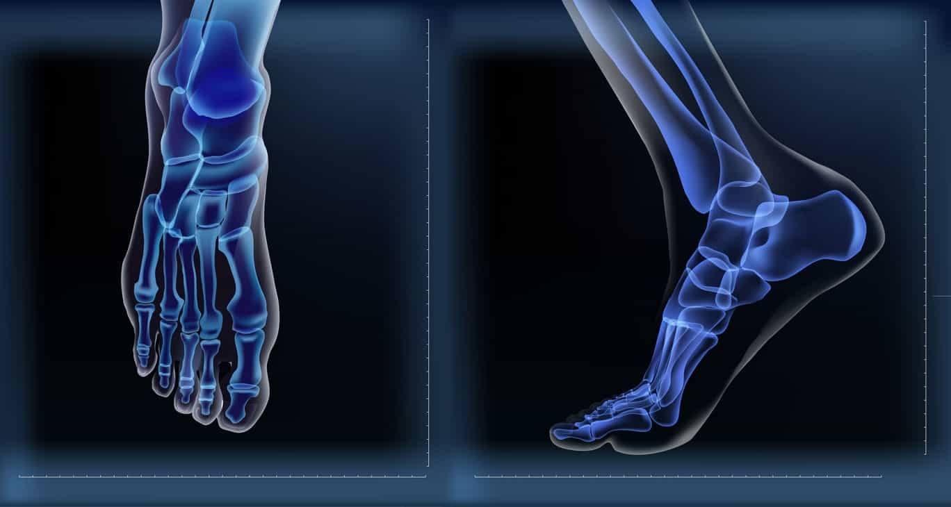pain points in the foot