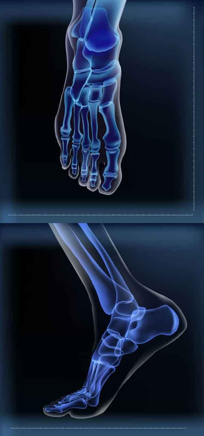 pain points in the foot