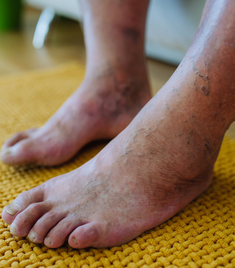 Person holding foot in pain