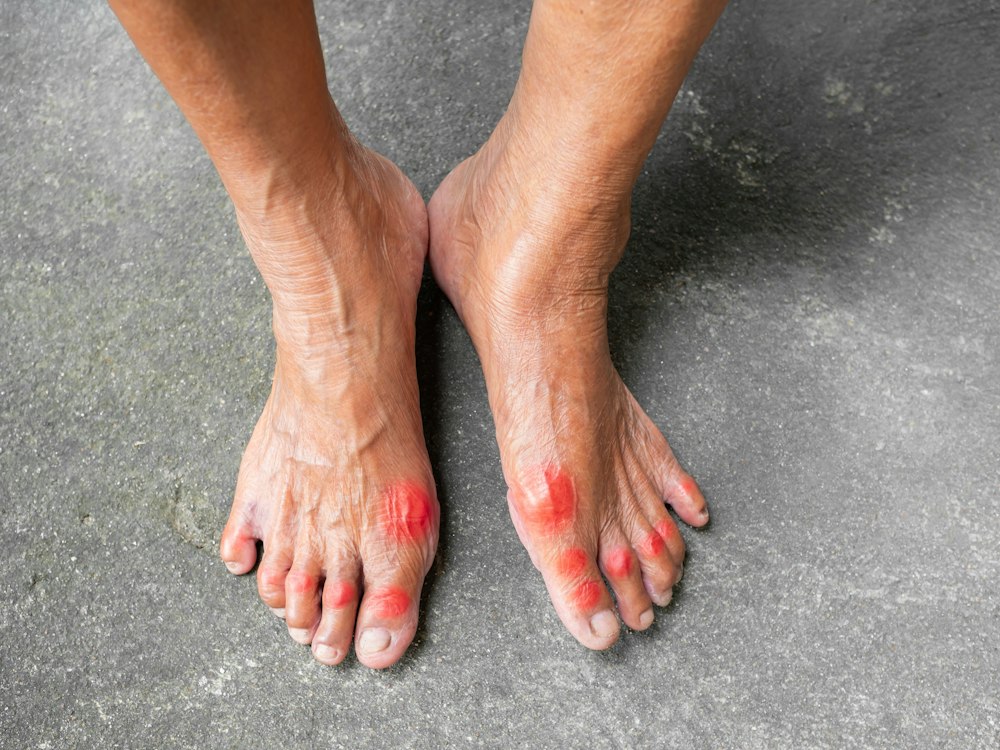 man